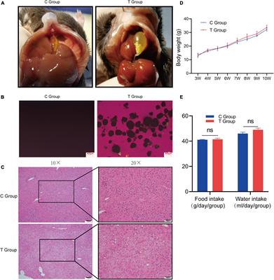 Changes and Correlations of the Intestinal Flora and Liver Metabolite Profiles in Mice With Gallstones